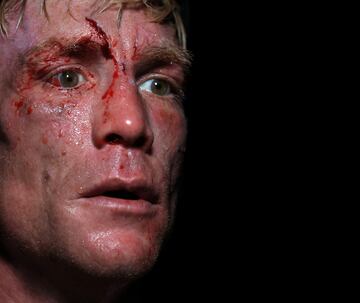 El BKB (Bare-knuckle boxing) es el deporte del boxeo sin el uso de guantes de boxeo u otro acolchado en las manos de los participantes.