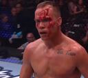 UFC en estado puro: el impactante KO con la cara ensangrentada tras recibir muchos golpes