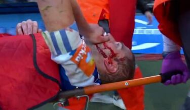 Bergantiños, retirado en camilla y luego al hospital con hemorragia