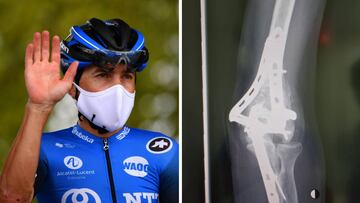 Domenico Pozzovivo saluda antes de una etapa en el Tour de Francia, donde ha competido con clavos y placas en su codo pese a la dura ca&iacute;da sufrida en la primera etapa.