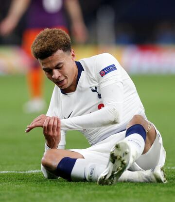 Dele Alli se lesionó y tuvo que ser sustituido.