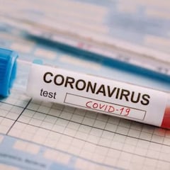 Prueba del coronavirus: dónde hacerla y cuánto cuesta en USA