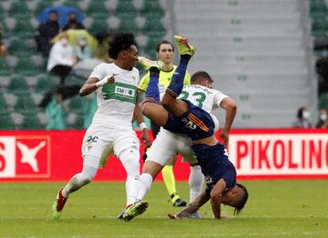 El jugador del Real Madrid ha sufrido una aparatosa caída durante el partido de liga ante el Elche, que le ha supuesto una rotura en la nariz que le hará pasar por el quirófano.