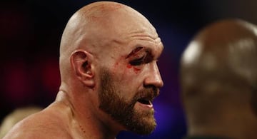 Tyson Fury tras acabar cortado el combate ante Wallin.