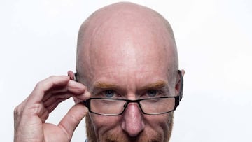 Última moda contra la alopecia: injerto capilar en Turquía