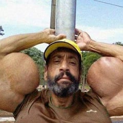 Muere a los 55 años el ‘Hulk brasileño” que se inyectaba synthol en los músculos