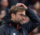 Klopp undecided on goalkeepers