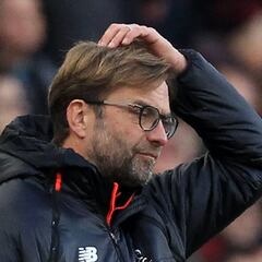 Klopp undecided on goalkeepers