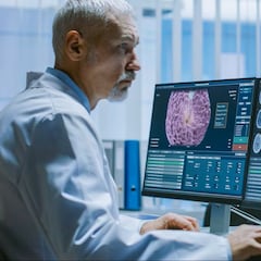 Del microscopio a la nube: así está transformando la IA el trabajo de patólogos y oncólogos