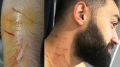 Çalar, banned for life for stabbing opposition players during game