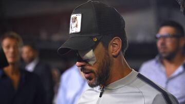 Pablo Pérez, descartado para la final por problemas en el ojo