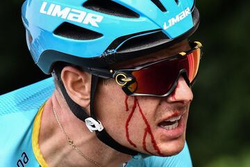 Jakob Fuglsang sufrió una dura caída durante la primera etapa del Tour de Francia 2019. Acabó con sangre en la cara. 