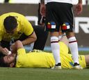 Fractura nasal tiene en vilo a Paulo Garcés en Colo Colo