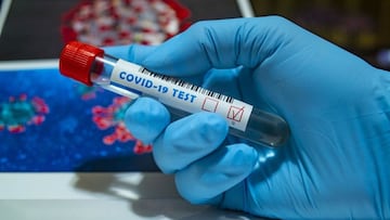 Coronavirus México: sedes de pruebas rápidas en Iztapalapa