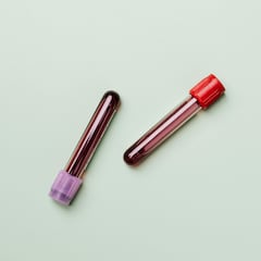 Una investigación sugiere que las personas con este tipo de sangre tienen más posibilidades de llegar a los 100 años