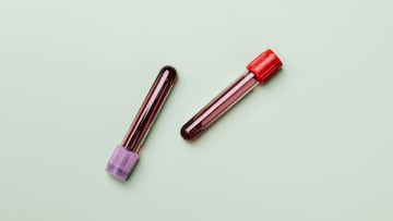 According to a scientific study cited by Time magazine, this blood type is associated with a lower risk of strokes or heart attacks.