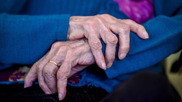 This picture shows Hermine Saubion's hands, 110, at her retirement house on January 28, 2022 in Banon, southern France.