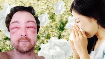 10 cosas que demuestran que los alérgicos tienen superpoderes