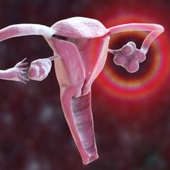 Encuentran microplásticos en ovarios de mujeres