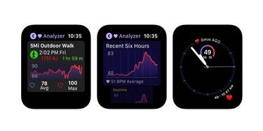Novedades Apple Watch: cambios en la app del sensor cardíaco