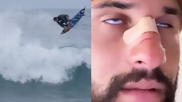 El campeón olímpico de surf Italo Ferreira, a la izquierda,tirando un aéreo en Margaret River (Australia). A la derecha, su cara con una tirita en la nariz (rota). Todo, a finales de abril del 2022.