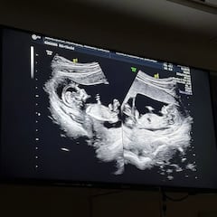 “Me explota el corazón, hay mellizos en camino... Nuestras vidas darán un vuelco maravilloso”