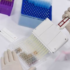 Seroprevalencia en Estados Unidos: hay 10 veces más casos que los contabilizados