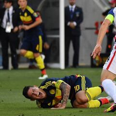 Alarma James: se fue lesionado de su hombro izquierdo