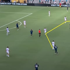 Xabi saca el bisturí