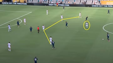 Xabi saca el bisturí