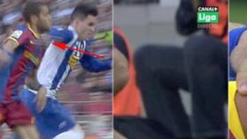 Alves bajo sospecha: le dan en el cuello, le duele la cara