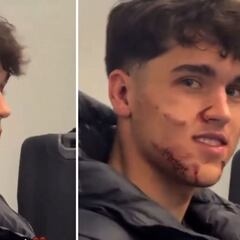 Mala noticia en el Barça: Cubarsí, fuera tras un fuerte golpe