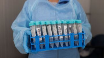 A nurse holds PCR samples hours before the start of a concert, at the Hospital Clinico de la Universidad de Chile, in Santiago, Chile, August 26, 2021. REUTERS/Pablo Sanhueza
