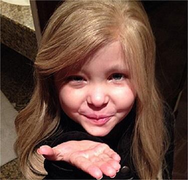 Finalmente, la niña Lacey murió