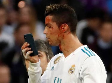 Cristiano Ronaldo checks bloody face on doctor's mobile