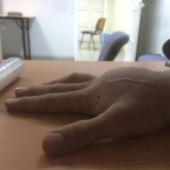 Petrucci: muestra en Twitter su mano antes de ser intervenido