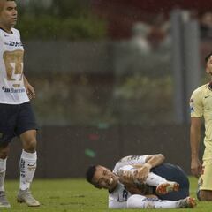 Los expertos opinan sobre las dos expulsiones de América