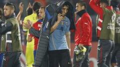 Fucile: "Alexis Sánchez tiene un problema mental"