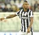Allegri: "La rodilla de Arturo Vidal está sufriendo"