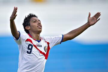 Costarricese que fue registrado con Pachuca para el Apertura 2017. Nunca pudo jugar con los Tuzos en la Liga MX y solo vio acción con la Sub-20 durante un año.