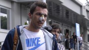 Mandzukic recibe el alta: "Podría jugar en diez días con máscara"