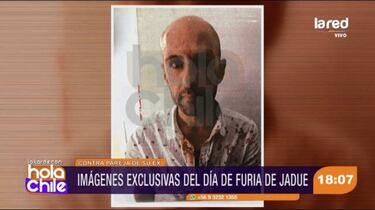 Las fotos de Sergio Jadue ensangrentado en Miami