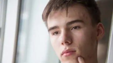 ¿Harto del acné? Sigue estos pasos y ve los resultados en tu rostro