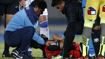 Magalhaes está consciente y estable tras su dura caída