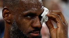 Will LeBron James play against Serbia in Paris 2024 Olympic semifinals after receiving stitches?