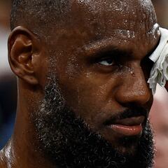 Will LeBron James play against Serbia in Paris 2024 Olympic semifinals after receiving stitches?