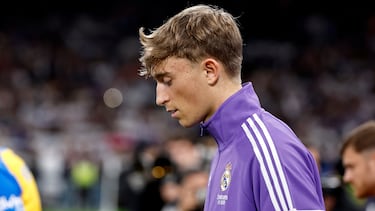 Contractura cervical de Asencio: “No veía claro, no me movía, perdí fuerza...”