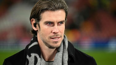 Los futbolistas que se sometieron a tratamientos estéticos para mejorar su imagen: ¿Los reconoces?