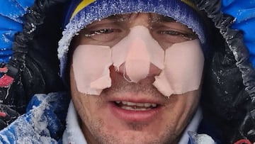 Andrew Ushakov en la Antártida, equipado contra el frío y con tiritas en la cara