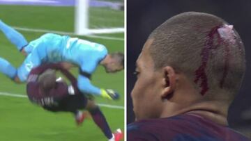 Mbappé retirado en camilla tras sufrir una dura entrada.